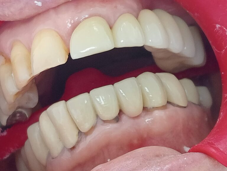 dental