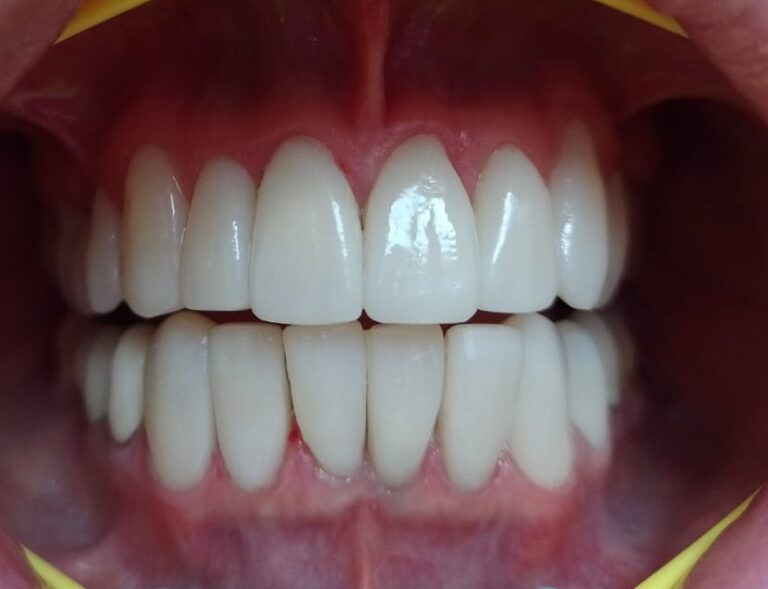 dental2