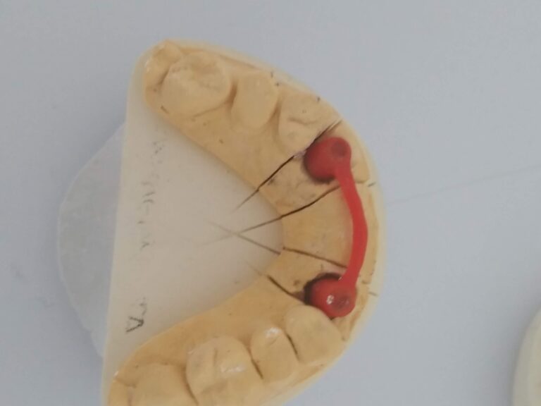 dental3