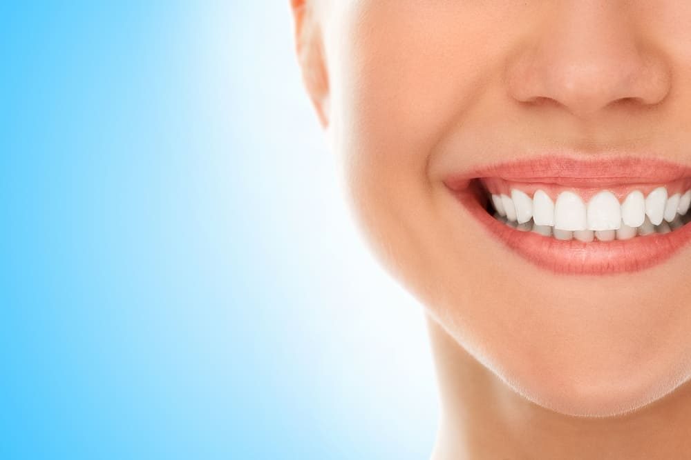 diseno de sonrisas