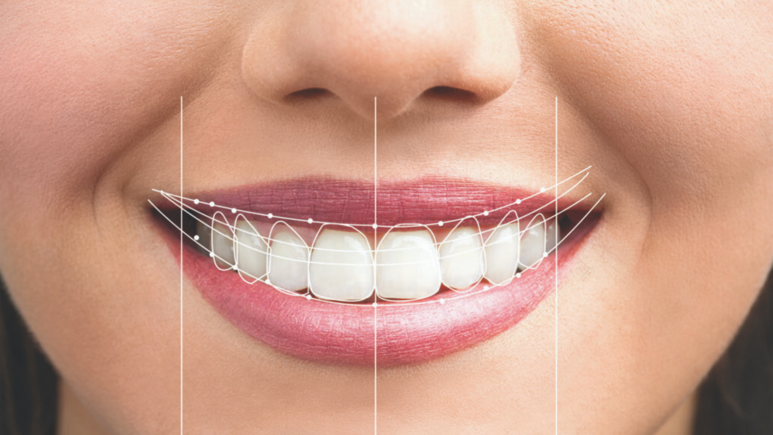 Valoración para diseño de sonrisa en Medellín