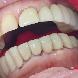 dental