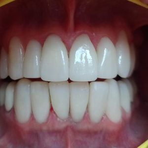 dental2