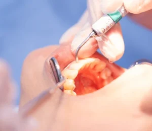 periodoncia 3