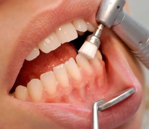 periodoncia