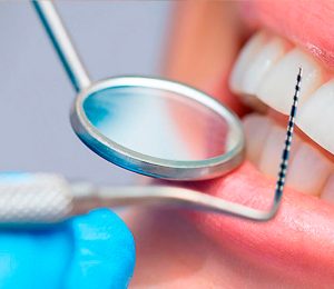 periodoncia3